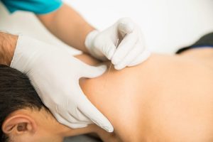 intramuscular stimulation IMS therapy